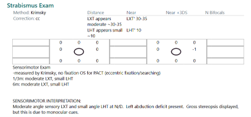 Strabismus Exam