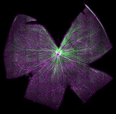 Miesfeld Lab_Glaucoma_P30