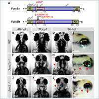 2020_Disruption of foxc1 genes