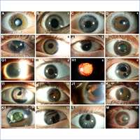 2024_In Vivo Assessment of Retinal Phenotypes