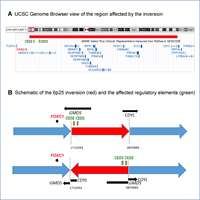 2025_Displacement of distant regulatory elements of FOXC1
