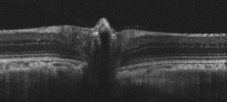 Noninvasive Assessment of the Visual System in Animal Models