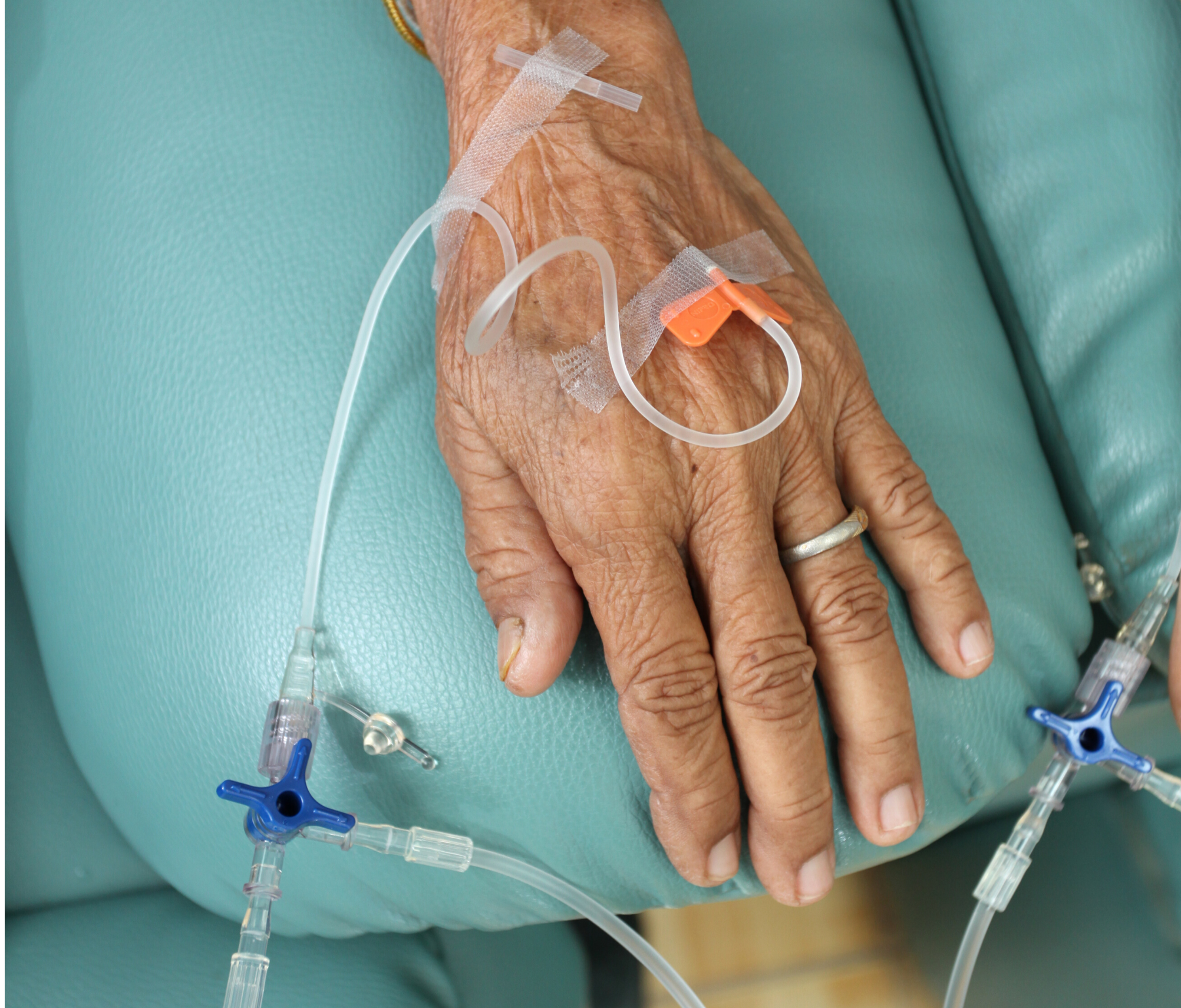 Patient hand receiving chemo.