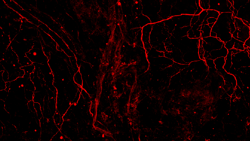 Mickle Lab_angiotensin signaling in the bladder