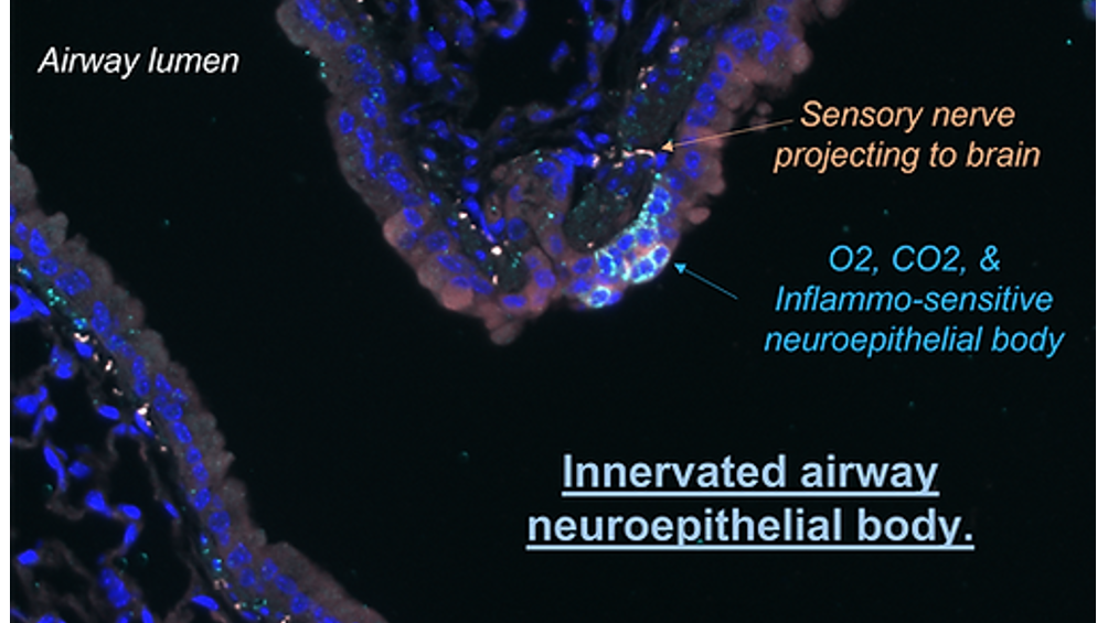Pulmonary Neuroendocrine Cells