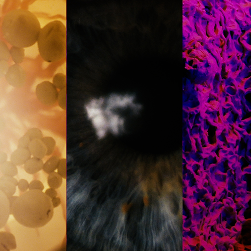 Project Wonder_Retina Refuse_thumbnail