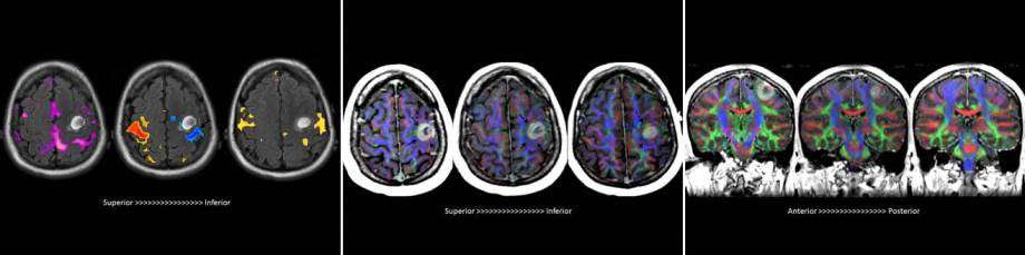 Neuroradiology Brain Mapping Advanced Brain Banner