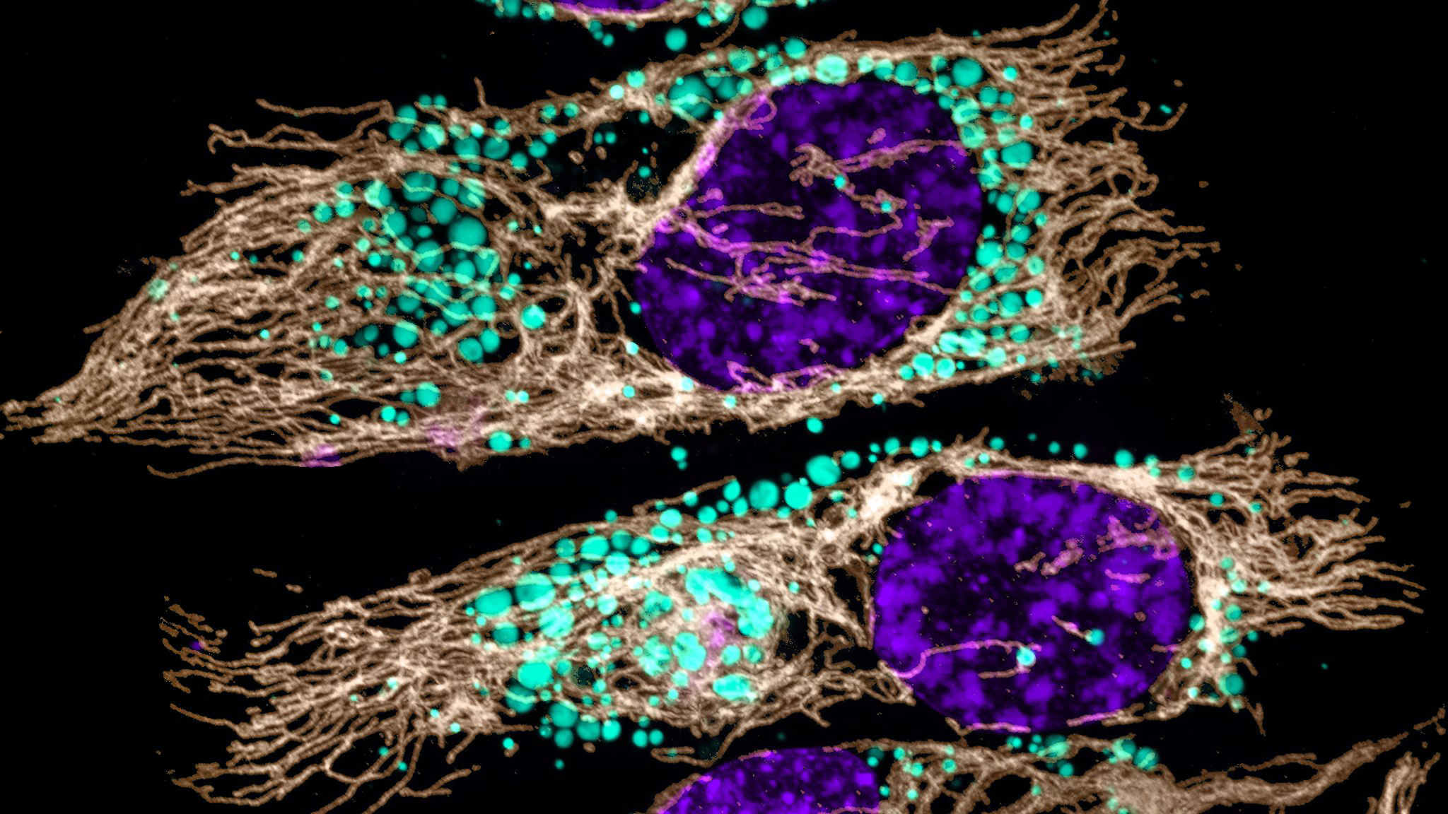 Microscope image of mitochondria