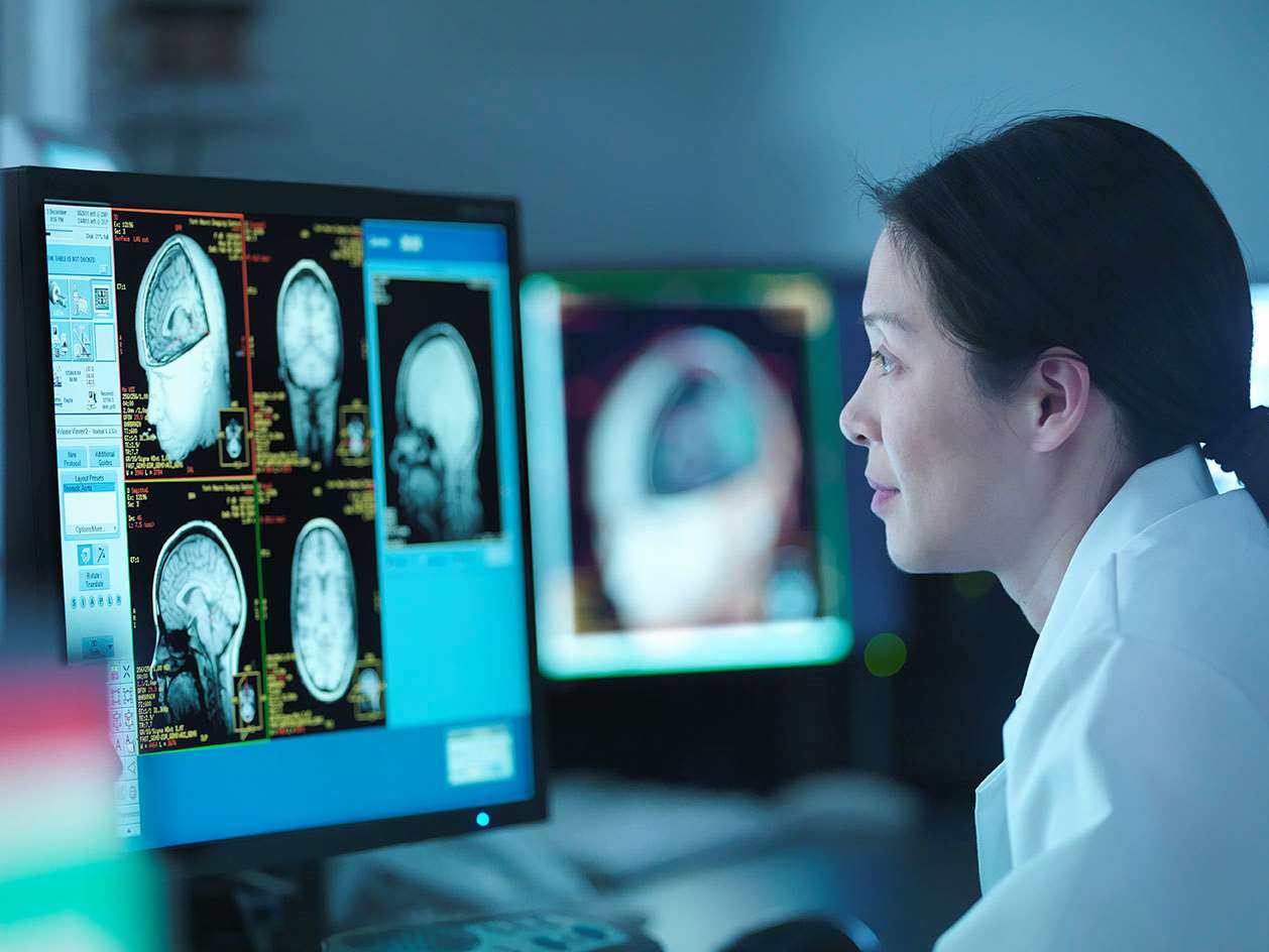 Female studies brain image on monitor