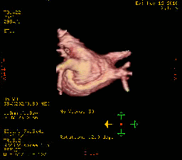lab scan