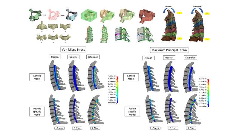 Examples of computational modeling of the cervical spine